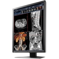 Moniteur LCD RadiForce RX250 22 po Classe - 3:4 - Noir EIZO - 21,3 po Visible - Technologie IPS - LED Rétroéclairage - 1200 x 1600 - 1,07 milliard de couleurs - 800 cd/m² - 20 ms - 60 Hz Fréquence de rafraîchissement - DVI - DisplayPort - Concentrateur USB