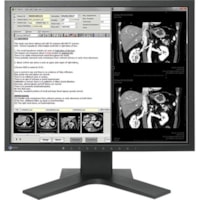 Moniteur LCD RadiForce MX194 SXGA - 5:4 - Noir EIZO - 18,9 po Visible - LED Rétroéclairage - 1280 x 1024 - 1,07 milliard de couleurs - 350 cd/m² - 20 ms - DVI - VGA - DisplayPort